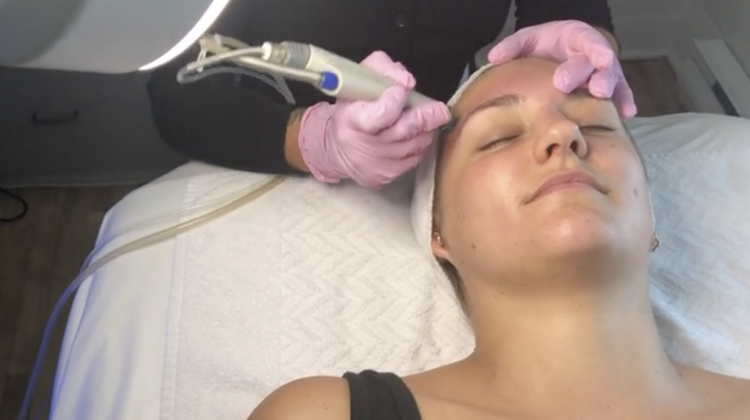 Emma Gets a Hydrafacial