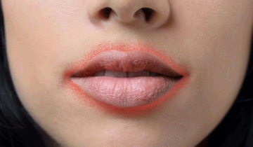 Understanding Perioral Dermatitis: What It Is, What Triggers It & How to Manage