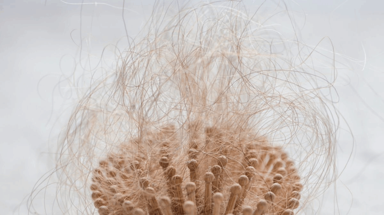 Losing Your Hair? These Products Can Help!